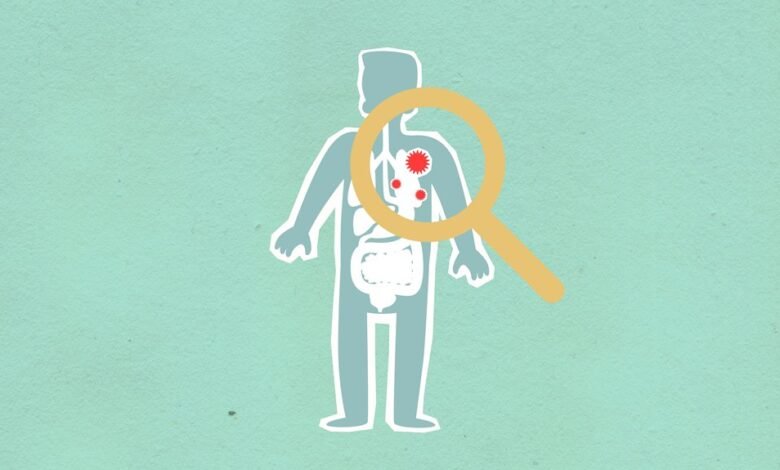 why how kialodenzydaisis kills